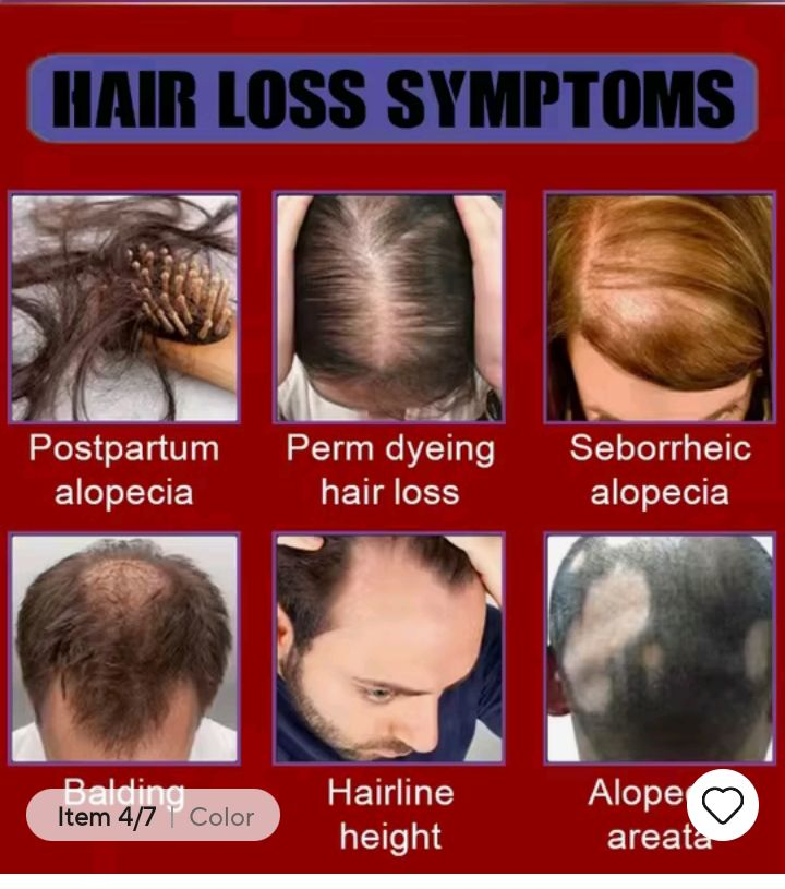 Tratamiento para la pérdida de cabello Ac63427377243139122